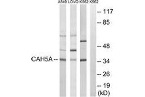 Western blot analysis of extracts from A549/LOVO/K562 cells, using CA5A Antibody. (CA5A antibody  (AA 171-220))