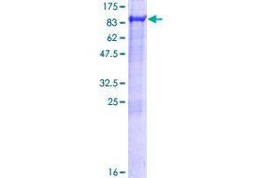 AHCYL2 Protein (AA 1-611) (GST tag)