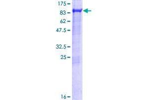 Image no. 1 for Adenosylhomocysteinase-Like 2 (AHCYL2) (AA 1-611) protein (GST tag) (ABIN1344628) (AHCYL2 Protein (AA 1-611) (GST tag))