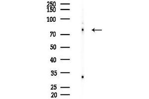 Western blot analysis of lysates from HepG2 cells(LPS, 4h treatment), using ITG Antibody at 1/1000 dilution.