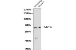 Western blot analysis of extracts of various cell lines, using CYP27B1 antibody (ABIN6130955, ABIN6139327, ABIN6139328 and ABIN6218814) at 1:3000 dilution. (CYP27B1 antibody  (AA 25-195))
