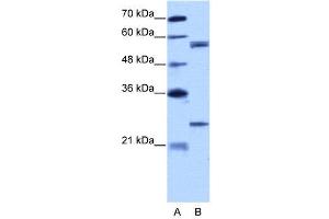 WB Suggested Anti-CPNE1  Antibody Titration: 5. (CPNE1 antibody  (N-Term))