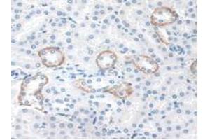 IHC-P analysis of Mouse Kidney Tissue, with DAB staining. (STAM2 antibody  (AA 1-377))