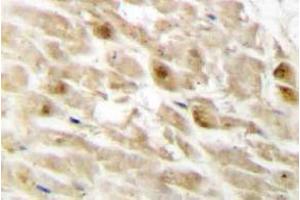 Immunohistochemistry (IHC) analyzes of PEBP2beta antibody in paraffin-embedded human heart tissue. (CBFB antibody)