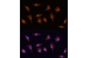 Immunofluorescence analysis of L929 using KDM5B antibody (ABIN6132287, ABIN6142802, ABIN6142803 and ABIN6223724) at dilution of 1:100 (40x lens). (KDM5B antibody  (AA 784-883))