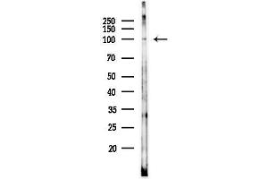 anti-phosphorylase, Glycogen, Liver (PYGL) (pSer15) antibody