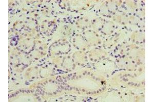 Immunohistochemistry of paraffin-embedded human pancreatic tissue using ABIN7169409 at dilution of 1:100 (SESN3 antibody  (AA 1-310))
