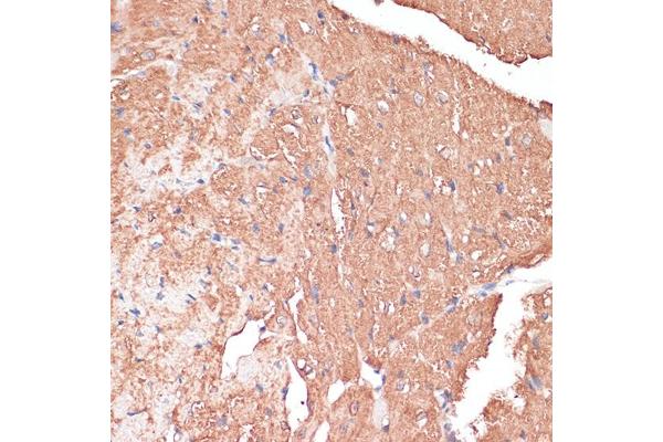 FRMD6 antibody  (AA 405-614)