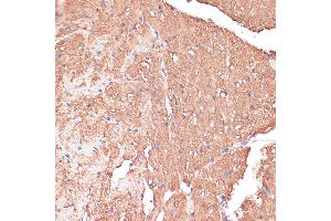 Immunohistochemistry of paraffin-embedded Mouse heart using FRMD6 antibody (ABIN6132194, ABIN6140773, ABIN6140774 and ABIN6225347) at dilution of 1:100 (40x lens).