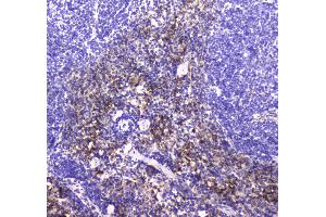 IHC analysis of NCR1 using anti-NCR1 antibody . (NCR1 antibody  (AA 22-258))