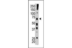The USP22 polyclonal antibody  is used in Western blot to detect USP22 in mouse brain tissue lysate . (USP22 antibody  (C-Term))
