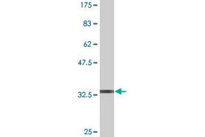 Western Blot detection against Immunogen (36. (PIM1 antibody  (AA 1-100))