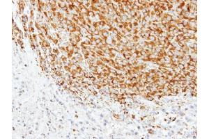 IHC-P Image Immunohistochemical analysis of paraffin-embedded SAS xenograft, using alpha Tubulin 1A, antibody at 1:500 dilution. (TUBA1A antibody)