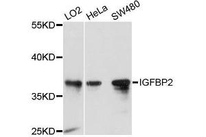 Western blot analysis of extracts of various cell lines, using IGFBP2 antibody. (IGFBP2 antibody  (AA 100-200))