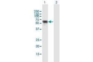 Western Blot analysis of NUP62 expression in transfected 293T cell line by NUP62 MaxPab polyclonal antibody. (NUP62 antibody  (AA 1-522))