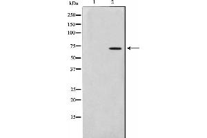 Western blot analysis on HuvEc cell lysate using Involucrin Antibody. (Involucrin antibody)
