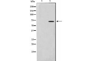 Western blot analysis on HuvEc cell lysate using Involucrin Antibody.