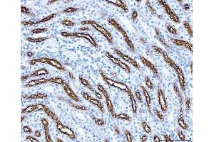 IHC analysis of SLC12A1 using anti-SLC12A1 antibody (ABIN3043925).