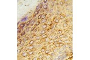 Immunohistochemistry analysis in formalin-fixed and paraffin-embedded human skin tissue reacted with LDHA Antibody (Center) Cat. (Lactate Dehydrogenase A antibody  (Middle Region))