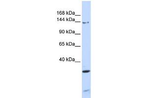 WB Suggested Anti-PIK3R4 Antibody Titration: 0. (PIK3R4 antibody  (N-Term))