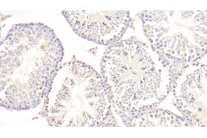 Detection of ERb in Mouse Testis Tissue using Polyclonal Antibody to Estrogen Receptor Beta (ERb) (ESR2 antibody  (AA 46-530))