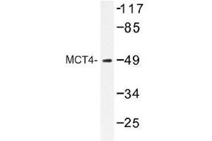 Image no. 1 for anti-Solute Carrier Family 16 (Monocarboxylic Acid Transporters), Member 3 (SLC16A3) antibody (ABIN317918) (SLC16A3 antibody)