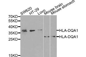 Western blot analysis of extracts of various cell lines, using HLA-DQA1 antibody (ABIN5971195) at 1/1000 dilution. (HLA-DQA1 antibody)