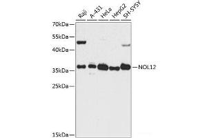 Western blot analysis of extracts of various cell lines using NOL12 Polyclonal Antibody at dilution of 1:3000. (NOL12 antibody)