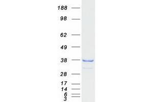 Validation with Western Blot