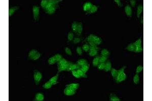 Immunofluorescent analysis of HepG2 cells using ABIN7150942 at dilution of 1:100 and Alexa Fluor 488-congugated AffiniPure Goat Anti-Rabbit IgG(H+L) (E2F3 antibody  (AA 1-108))