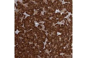 Immunohistochemical staining of human pancreas with FAM110C polyclonal antibody  shows strong cytoplasmic positivity in exocrine glandular cells at 1:200-1:500 dilution.