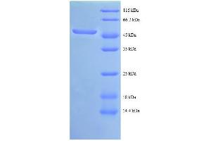 SDS-PAGE (SDS) image for C-Abl Oncogene 1, Non-Receptor tyrosine Kinase (ABL1) (AA 4-194), (partial) protein (GST tag) (ABIN5712349)