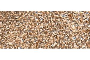 Immunohistochemistry of paraffin-embedded Human tonsil tissue using HOXC12 Polyclonal Antibody at dilution of 1:50(x200) (HOXC12 antibody)