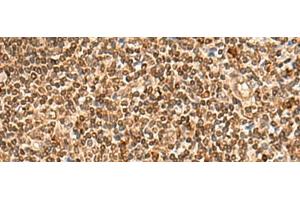 Immunohistochemistry of paraffin-embedded Human tonsil tissue using HOXC12 Polyclonal Antibody at dilution of 1:50(x200)