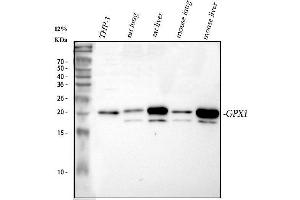 Western blot analysis of GPX1 using anti-GPX1 antibody (ABIN3043834).