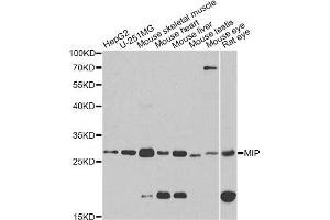 Western blot analysis of extracts of various cell lines, using MIP antibody (ABIN1873696) at 1:1000 dilution. (MIP antibody)