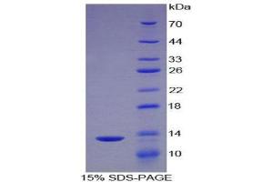 SDS-PAGE (SDS) image for Chemokine (C-C Motif) Ligand 16 (CCL16) (AA 24-120) protein (His tag) (ABIN2120795) (CCL16 Protein (AA 24-120) (His tag))