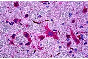 Rat Brain: Formalin-Fixed, Paraffin-Embedded (FFPE) (CAMK2B antibody)