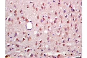Formalin-fixed and paraffin embedded rat brain labeled with Anti-Phospho-RSK2 (Ser227) Polyclonal Antibody, Unconjugated (ABIN745268) at 1:200 followed by conjugation to the secondary antibody and DAB staining (RPS6KA3 antibody  (pSer227))