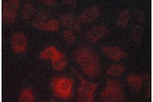 ABIN6268913 staining lovo cells by ICC/IF. (GRP78 antibody)