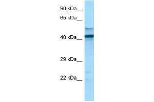 WB Suggested Anti-FCGR1A Antibody Titration: 1. (FCGR1A antibody  (C-Term))