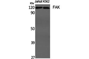 Western Blotting (WB) image for anti-PTK2 Protein tyrosine Kinase 2 (PTK2) (Tyr407) antibody (ABIN5960987) (FAK antibody  (Tyr407))