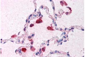 Human Lung (formalin-fixed, paraffin-embedded) stained with IFNB1 antibody ABIN213936 at 5 ug/ml followed by biotinylated goat anti-rabbit IgG secondary antibody ABIN481713, alkaline phosphatase-streptavidin and chromogen. (IFNB1 antibody  (Internal Region))