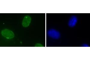 DHX9 antibody (mAb) (Clone 8E3) tested by Immunofluorescence. (DHX9 antibody  (N-Term))