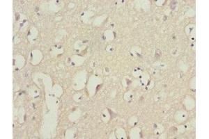 Immunohistochemistry of paraffin-embedded human brain tissue using ABIN7163171 at dilution of 1:100 (PIK3R3 antibody  (Regulatory Subunit Gamma))