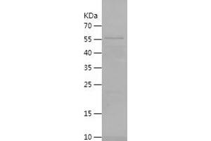 Western Blotting (WB) image for Deoxyribonuclease I-Like 3 (DNASE1L3) (AA 21-305) protein (His-IF2DI Tag) (ABIN7122636) (DNASE1L3 Protein (AA 21-305) (His-IF2DI Tag))