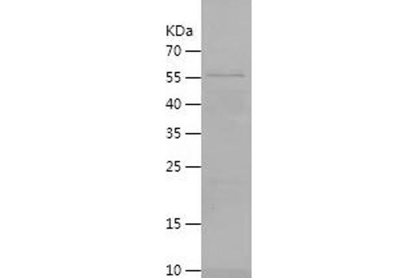 DNASE1L3 Protein (AA 21-305) (His-IF2DI Tag)