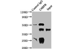 Immunoprecipitating C4BPB in HepG2 whole cell lysate Lane 1: Rabbit control IgG instead of ABIN7146168 in HepG2 whole cell lysate. (C4BPB antibody  (AA 18-252))