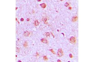 Immunohistochemical analysis of PFKP staining in human brain formalin fixed paraffin embedded tissue section. (PFKP antibody  (Center))