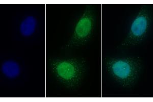 Detection of LSR in Human HepG2 cell using Polyclonal Antibody to Lipolysis Stimulated Lipoprotein Receptor (LSR) (LSR antibody  (AA 35-205))